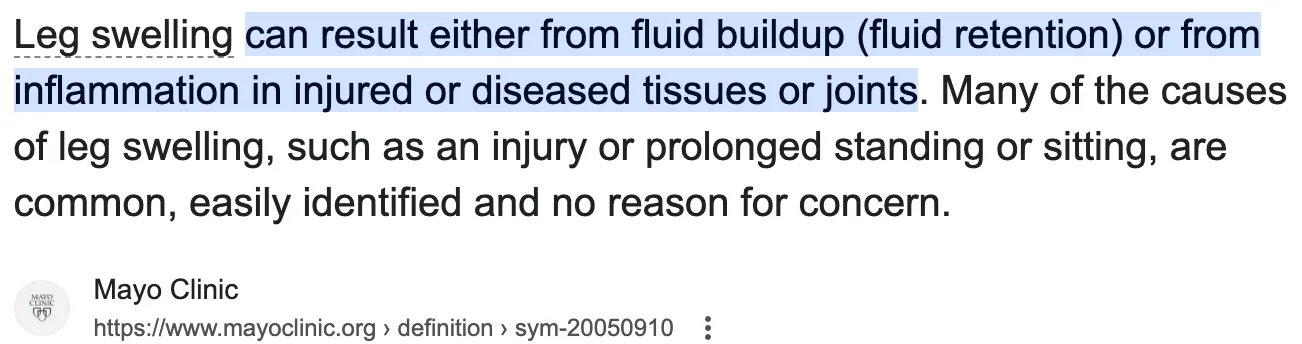 Google search result from Mayo Clinic explaining that leg swelling can result from fluid buildup or inflammation in injured or diseased tissue