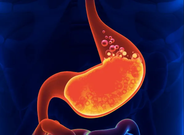 Six Things Employees Should Know about Heartburn (Part Two) illustration