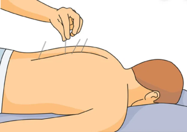 Six things employees should know about back pain illustration