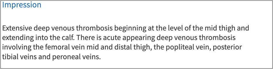 Radiology impression text reporting extensive deep venous thrombosis extending from the mid-thigh into the calf