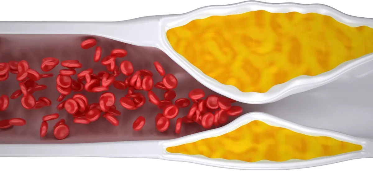 Six things employees need to know about stents illustration