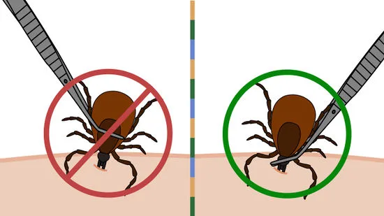 The ticks are back...and they're hungry. illustration